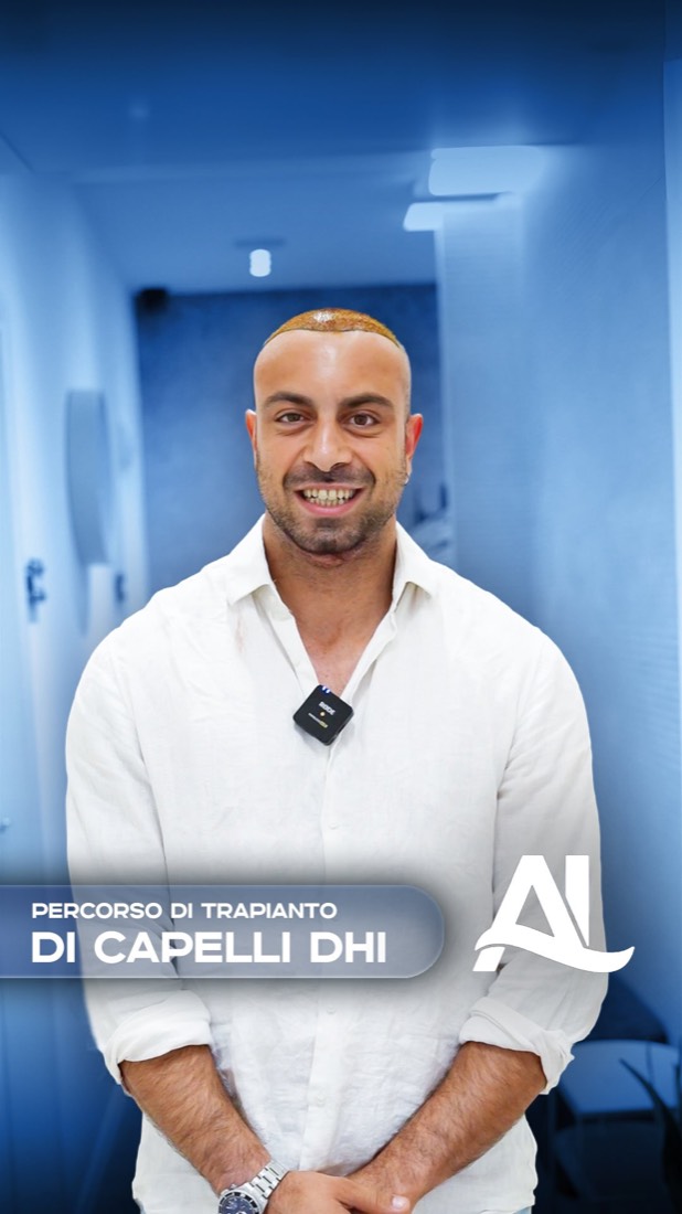 Trapianto di capelli